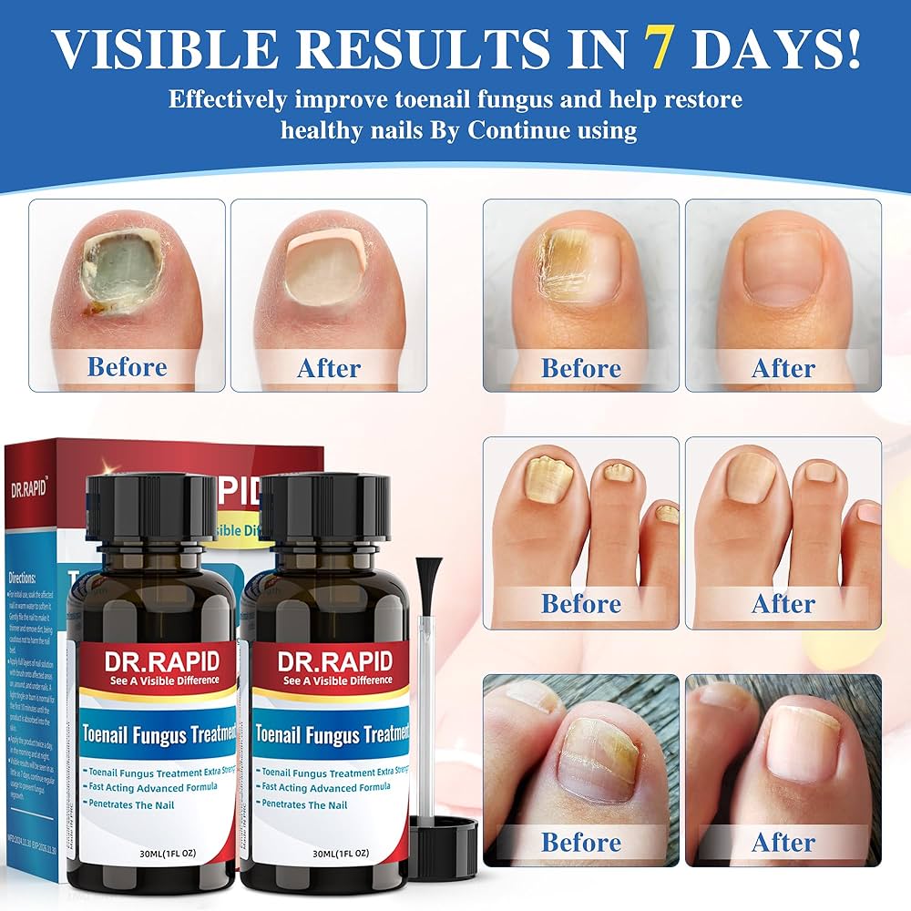 4 Best Antifungal Nail Treatment For Toes (2026 Review Guide)